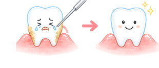 歯周病治療のイラスト